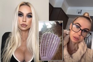 Simona Milinytė parodė šiurpą keliančią vėžio gydymo pusę: sunkiai tvardė emocijas