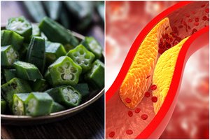 Vaisius, kuris valo kraujagysles: „suriša“ cholesterolį ir pašalina iš organizmo