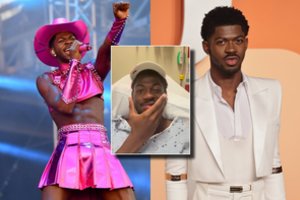 Reperis Lil Nas X atsidūrė ligoninėje – netikėtai patyrė dalinį veido paralyžių