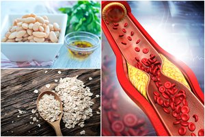 Išmokite kaip maldą: 10 maisto produktų, kurie mažina cholesterolį