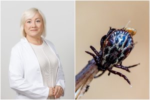 Šeimos gydytoja paaiškino, kodėl Lietuva pirmauja pagal erkinio encefalito atvejų skaičių