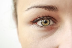 Vaistininkė: tamsūs ratilai po akimis gali atsirasti visai ne dėl nuovargio