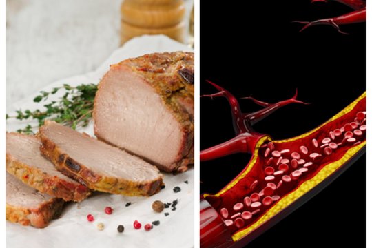Maisto produktai, kurių turite vengti, jei turite aukštą cholesterolį