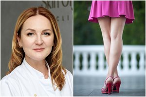 Gydytoja prašo suklusti – tai pirmieji kraujotakos sutrikimo signalai