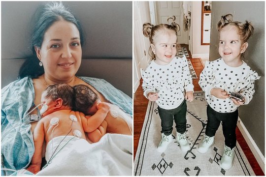 Siamo dvynukes pagimdžiusi mama pasidalino savo išgyvenimais: motinos meilė už viską stipresnė