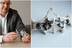 Žmogus staiga atjaunėja 10-čia metų: toks prarastų dantų atstatymo būdas – naujovė Lietuvoje