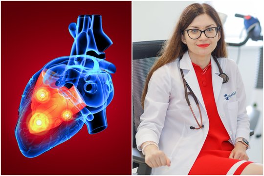 Įsidėmėkite: kardiologė išvardijo, kokius signalus siunčia organizmas, kai sustreikuoja širdis