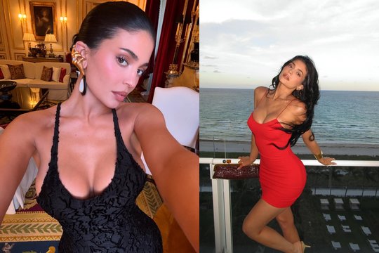 Kylie Jenner nustebino: atsisakė populiarių grožio procedūrų