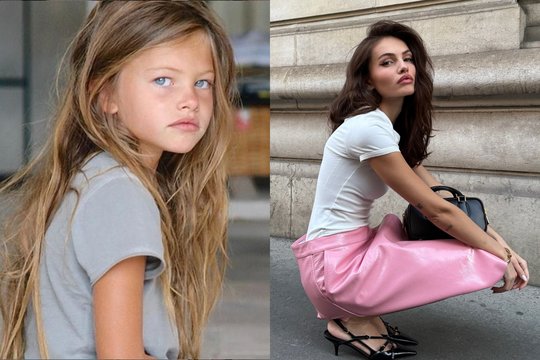 Gražiausia pasaulio mergaite vadinta T. Blondeau užaugo: prasitarė apie sveikatos problemas