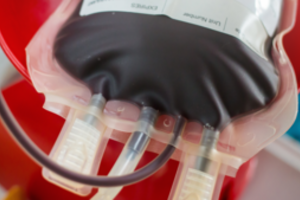 Švedijoje į kaulų čiulpų donorų registrą galės būti įtraukti nepilnamečiai