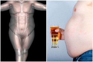 Didėjantis svoris vyrams: riebalai kaupiasi kitaip nei moterims – pasekmės itin rimtos