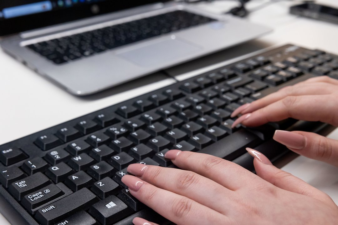 Pasidalijo, ką į sąnaudas „nurašo“ verslas: randa apatinių, banglenčių ar net krūtų pakėlimo operacijų