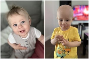 Akies vėžiu susirgusio 1,5 m. Adomo mama: „Norėčiau pabusti iš šio baisaus sapno“