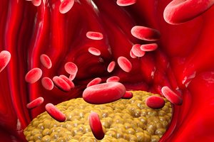 Atskleidė, kaip cholesterolis suvaldomas be vaistų: gelbsti nuo mirtinų ligų