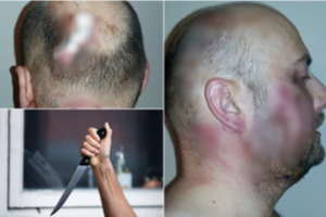 Kaune – teisėjų akibrokštas: smūgiai peiliu į galvą, pasirodo, nėra pasikėsinimas nužudyti