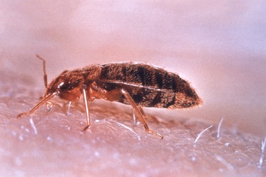 Susipažinkite: seniausias žmogaus parazitas, mus kamuojantis jau 60 000 metų