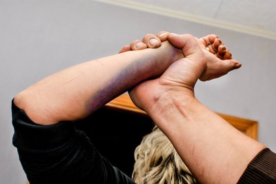 Muštynėmis pasibaigusios išgertuvės Tytuvėnuose: moteris pateko į ligoninę, vyras – į areštinę