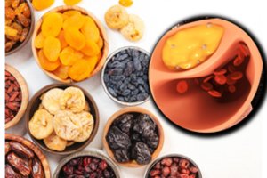 Mokslininkai atrado naują supermaistą, kuris padeda kontroliuoti cholesterolį: pakaks 50 gramų