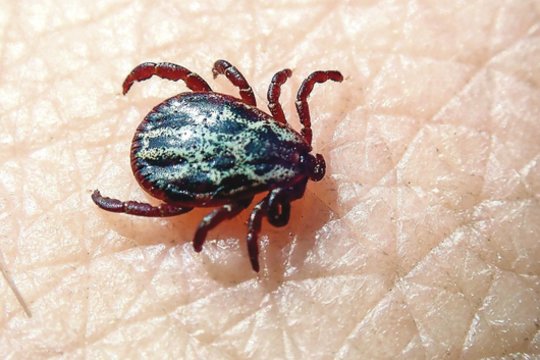 Gydytoja pasakė, ko šiukštu nedaryti įsisiurbus erkei: tik paskatins parazitą išskirti daugiau nuodų