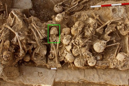Neįprastos formos galvą turėjusios moters mirtį gaubia paslaptis