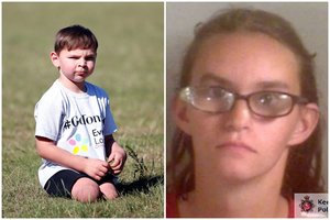 Tėvai savo vaiką taip baisiai nukankino, kad jis liko be kojų: protu nesuvokiama, kaip su juo elgėsi