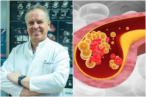 Kardiologas P. Šerpytis paneigė giliai šaknis įleidusį melą: nėra „Fairy“ kraujagyslėms išvalyti