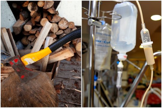 Kaune į ligoninę paguldyta per barnį bute kirviu sužalota moteris