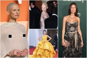 Seksualinę prievartą, skyrybas ir priklausomybę išgyvenusiai garsiai aktorei – dar vienas smūgis: išsioperavo krūtis, bet vėžys smogė kitur