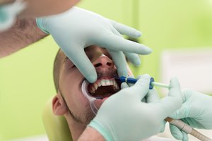 Nelegalus šeimos versliukas: apsimetę odontologais rovė dantis, gamino protezus ir uždirbo milijonus