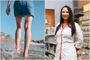 Vasarą tinsta kojos ar veidas? Štai ką organizmas bando pasakyti