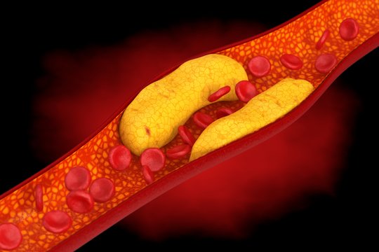 Mokslas įrodė: cholesterolio kiekį kraujyje mažina šis paprastas užkandis