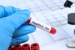 NVSC įspėja: Europoje plinta hepatitas A