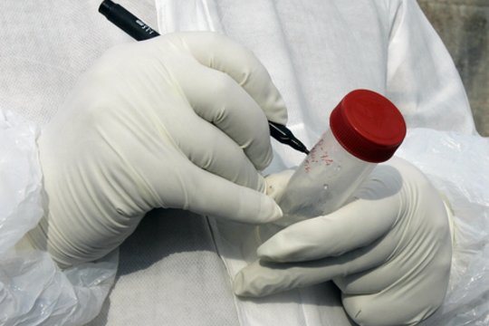 Italijoje patvirtintas pirmasis pavojingos infekcijos protrūkis – įvestos griežtos kontrolės priemonės