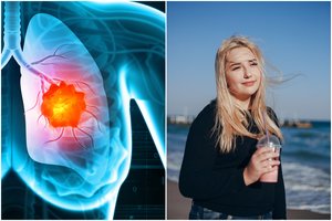 Plaučių vėžiu suserga daug žmonių, kurie niekada nerūkė – kas vyksta?