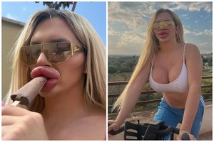 Lūpas pūtė tiek, kad nebegali jų sučiaupti: jaučiasi atrodanti „itin moteriškai“