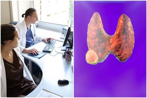 Medicinos studentui iš Kauno – kartus likimo pokštas: skydliaukės vėžys neturėjo jokių simptomų