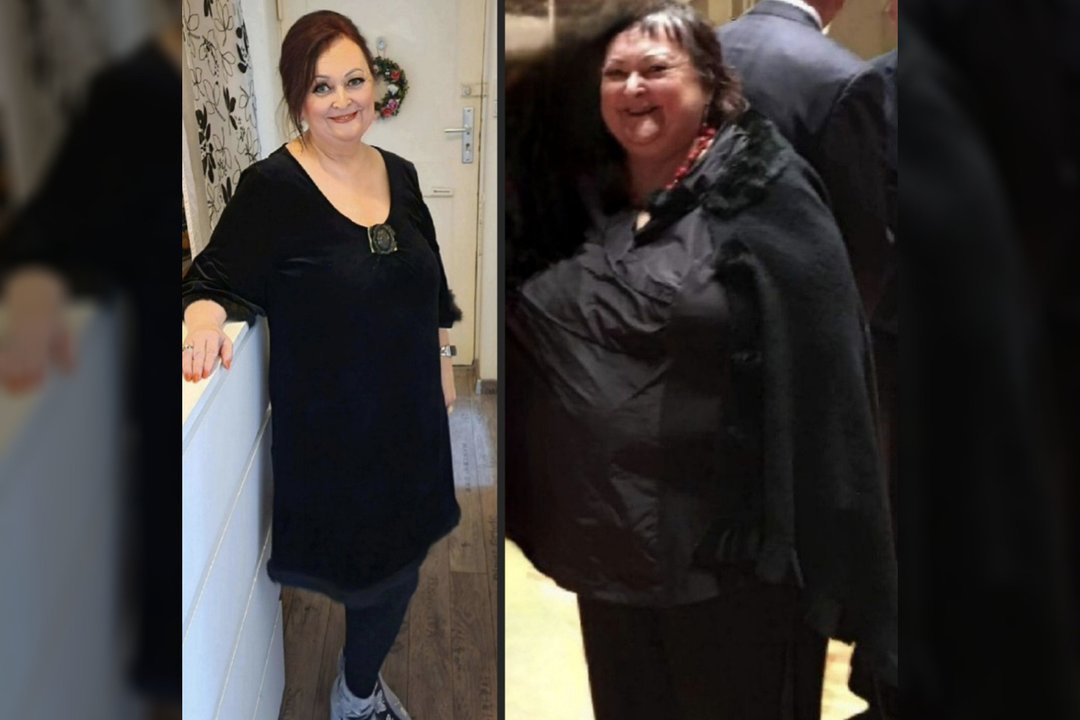 Jauno klaipėdiečio patarimo paklausę žmonės lengvai numeta ir po 60 kilogramų: pasakė, ką reikia daryti