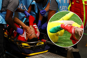 Paviešino „Bayern“ žvaigždės šiurpios traumos detales: „Šokas mums visiems“