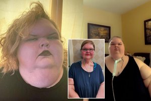 329 kg svėrusi realybės šou žvaigždė ryžosi žadą atimantiems pokyčiams: atskleidė, ką teko išgyventi