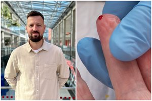 LSMU mokslininkas tyrinėja mikrobiotą: tikimasi proveržio ankstyvoje diagnostikoje ir gydyme