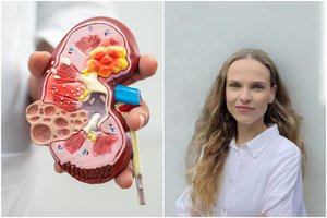 Tylus priešas – inkstų liga: dėl staigaus priepuolio pacientai guldomi ant operacinės stalo