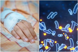 Europoje nepastebimai plinta mirtina liga: pirmas simptomas – gerklės skausmas