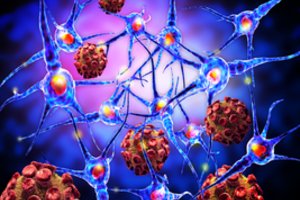 Baisus kancerogenas: virusas, kuriuo užsikrėtę žmonės vėžiu serga 5 kartus dažniau