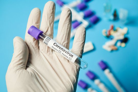 Išplito nauja COVID-19 atmaina: užsikrėtusiems pasireiškia specifinis simptomas