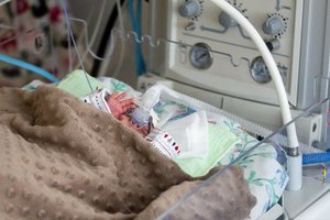 Kaune atidaryta pirmoji Lietuvoje dvyniams pritaikyta Šeimos-naujagimių intensyviosios terapijos palata