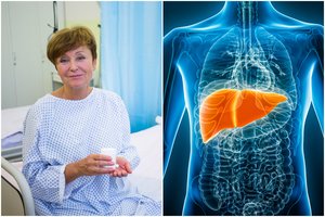 Kelias savaites gėrė populiarų maisto papildą ir atsidūrė ligoninėje – smarkiai kirto per kepenis