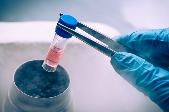 Biobankai Lietuvoje: kokiu tikslu kaupiami pacientų mėginiai?