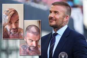 Davidas Beckhamas patyrė fiasko: tai, kas nutiko jam – nedažna