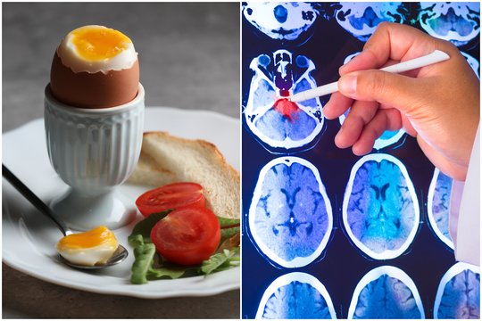Kiaušinių valgymas turi netikėtą poveikį smegenų sveikatai