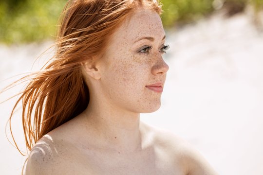 Strazdanos vasarą: kodėl jų padaugėja ir kaip prižiūrėti savo odą?